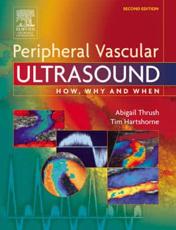 Peripheral Vascular Ultrasound