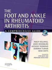 The Foot and Ankle in Rheumatoid Arthritis