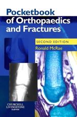 Pocketbook of Orthopaedics and Fractures