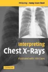 Interpreting Chest X-Rays: Illustrated with 100 Cases