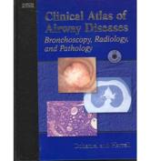 Clinical Atlas of Airway Disease