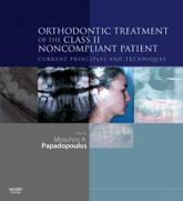 Orthodontic Treatment of the Class II Non-Compliant Patient