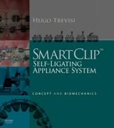 SmartClip Self-Ligating Appliance System: Concept and Biomechanics