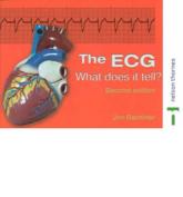 The ECG