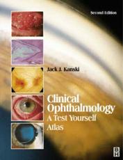 Clinical Ophthalmology: A Test Yourself Atlas