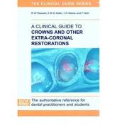 Clinical Guide to Crowns and Other Extra-Coronal Restorations
