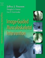 Image-guided Musculoskeletal Intervention