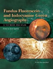 Fundus Fluorescein and Indocyanine Green Angiography
