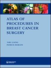 Atlas of Procedures in Breast Cancer Surgery with DVD