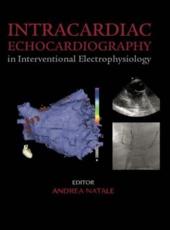 Intercardiac Echocardiography in Interventional Electrophysiology