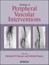 Textbook of Peripheral Vascular Interventions