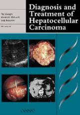 Diagnosis and Treatment of Hepatocellular Carcinoma
