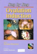 Step by Step Ovulation Induction