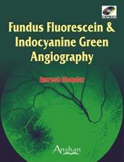 Fundus Fluorescein and Endocyanine Green Angiography