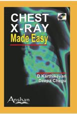 Chest X-rays Made Easy