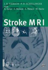 Stroke MRI