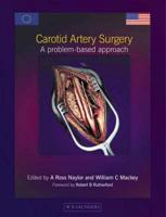 Carotid Artery Surgery
