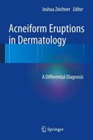 Acneiform Eruptions in Dermatology: A Differential Diagnosis