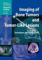 Imaging Bone Tumors and Tumor-Like Lesions