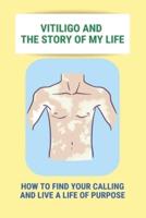 Vitiligo And The Story Of My Life